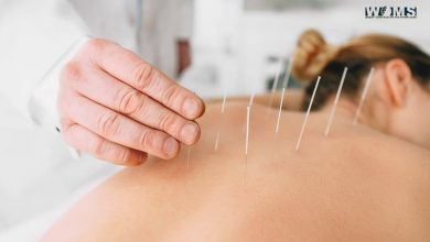 Acupuncture and Traditional Chinese Medicine