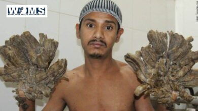 Bangladesh’s tree man