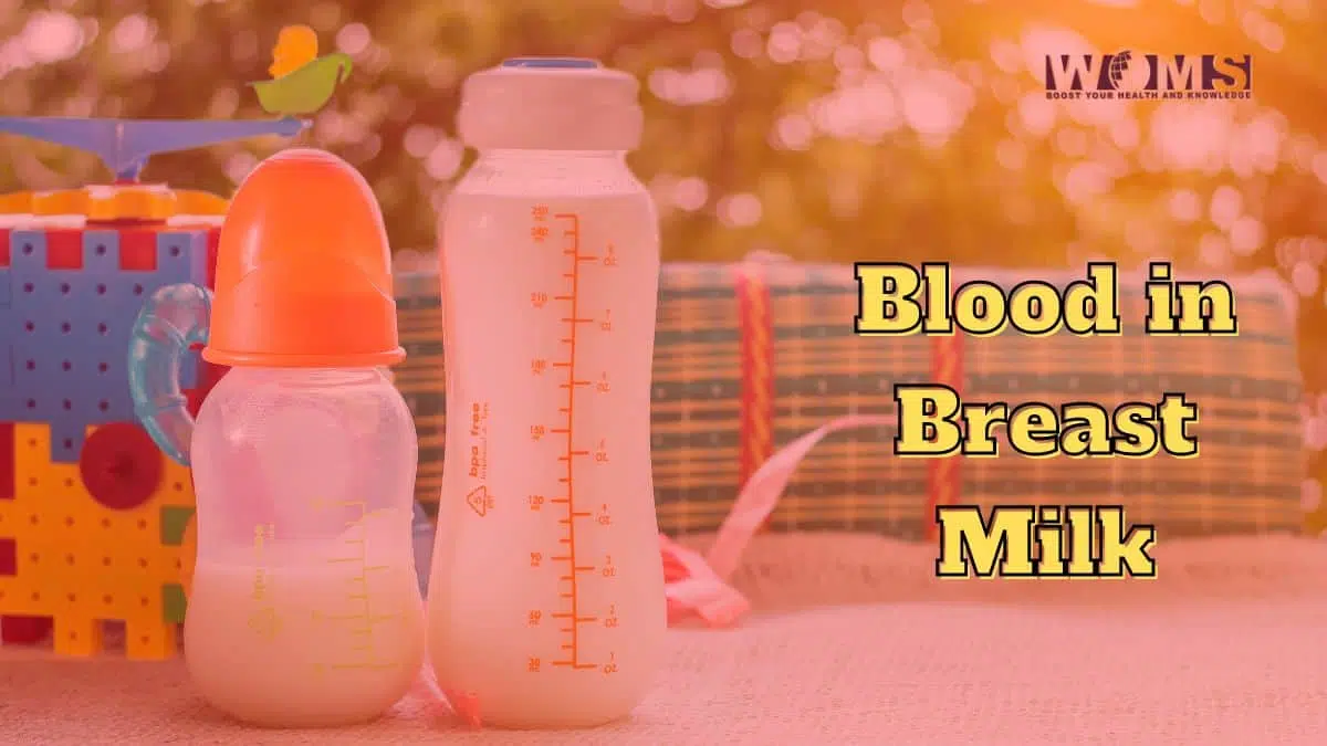 Blood in Breast Milk