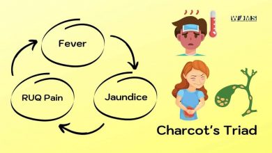 Charcot's-triad