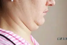 Double Chin Exercises