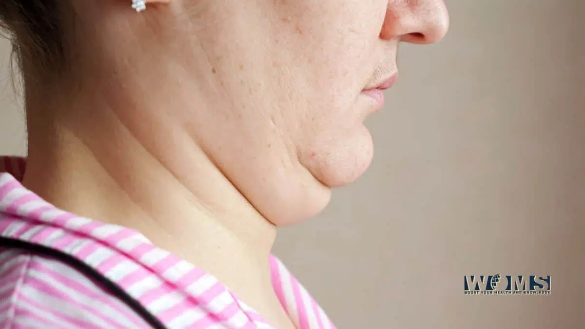 Double Chin Exercises