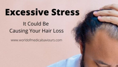 Excessive Stress: It Could Be Causing Your Hair Loss