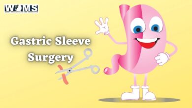 gastric sleeve surgery