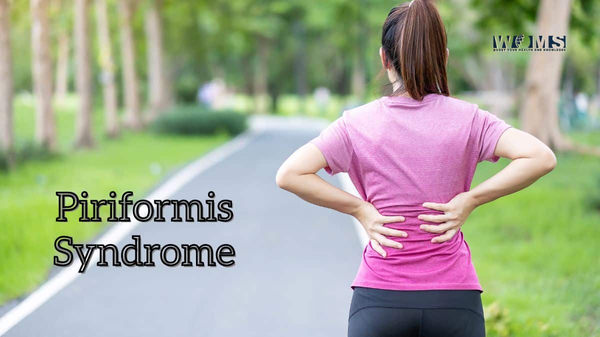 How to Sleep with Piriformis Syndrome