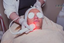 Laser Beauty Treatments