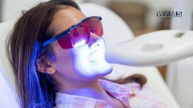 Laser Teeth Whitening