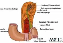 ligament of treitz