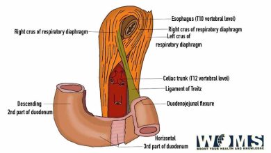 ligament of treitz