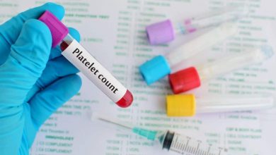 Normal Platelet Count