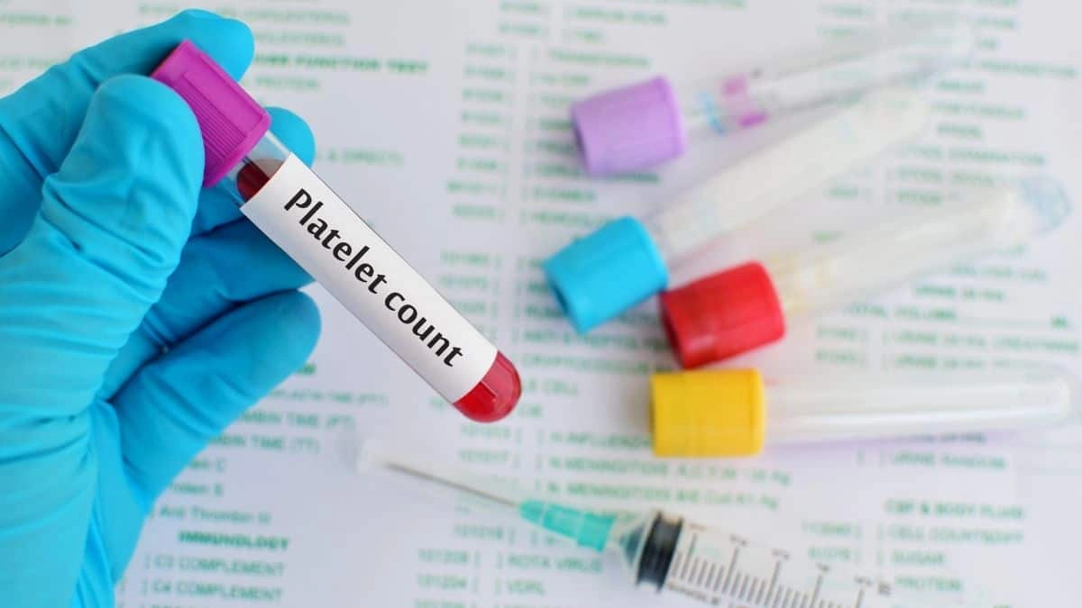 Normal Platelet Count