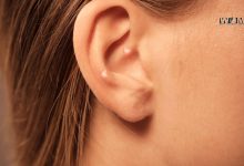 Pimple in Ear