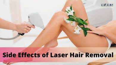 Side Effects of Laser Hair Removal