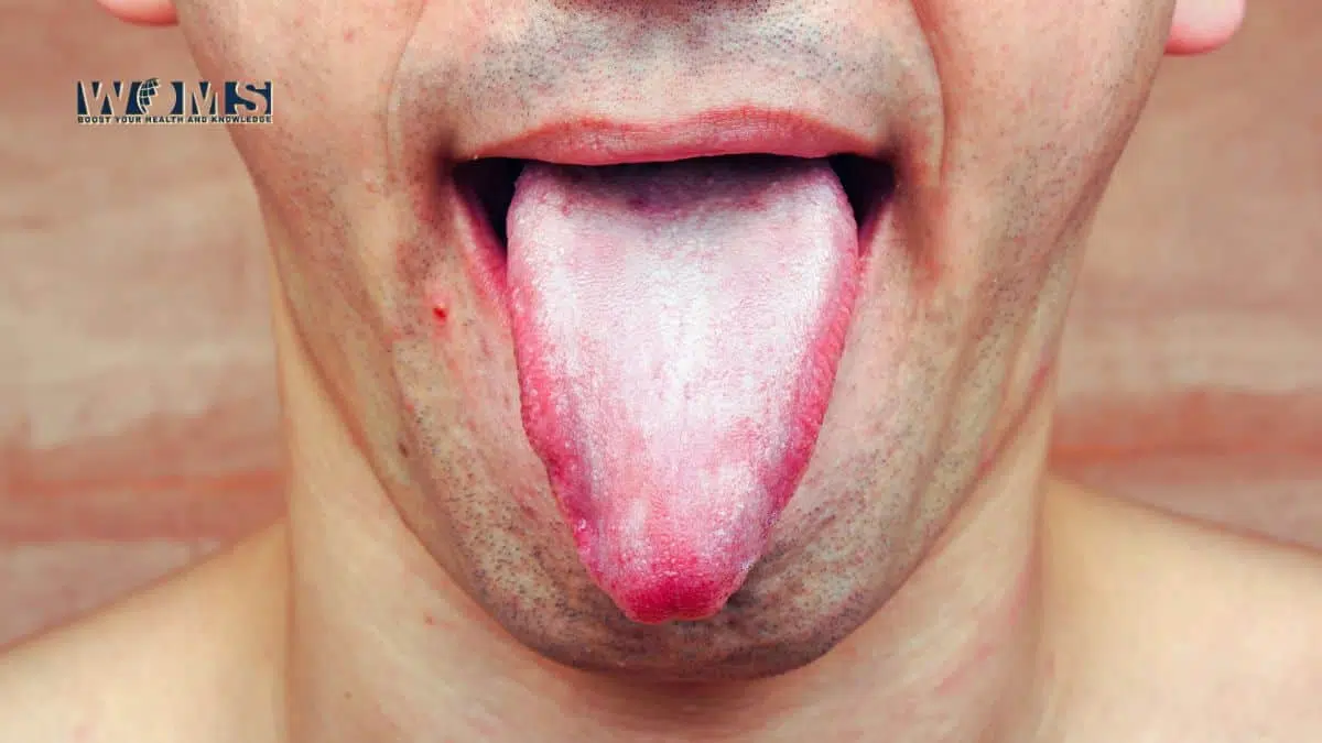 Tongue Muscles