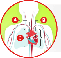 Heart failure guidelines for treatment