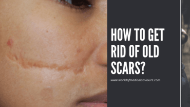 How to get rid of old scars-woms